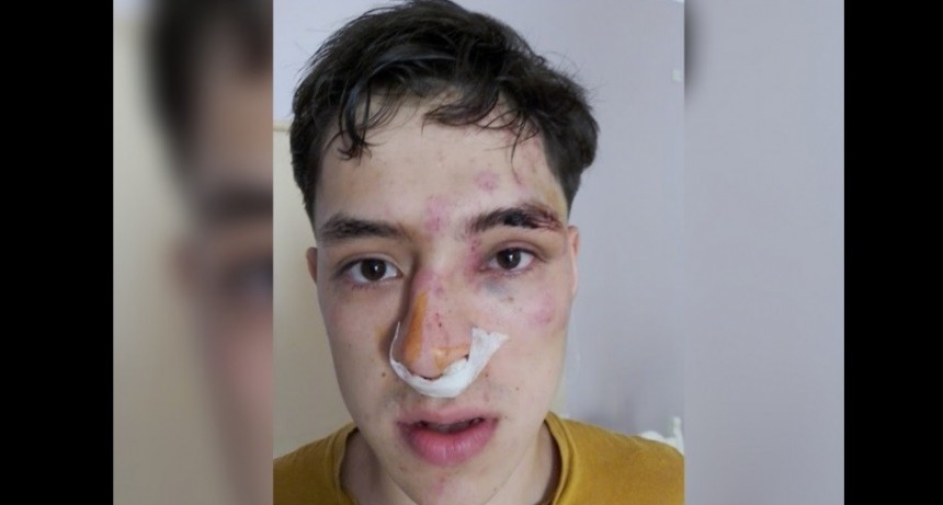 Violento ataque contra un joven a la salida de una fiesta en S&aacute;enz Pe&ntilde;a