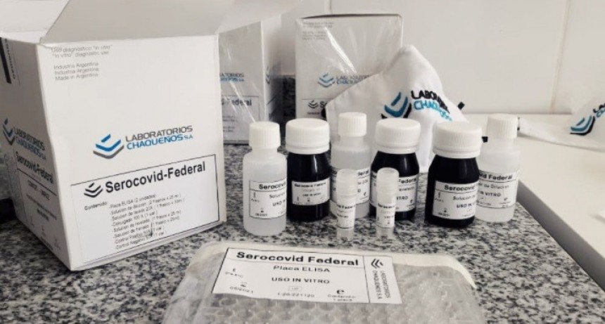 Kit que detecta anticuerpos para COVID-19: &ldquo;Creemos que en unos 30 d&iacute;as m&aacute;s estaremos en el mercado&rdquo;