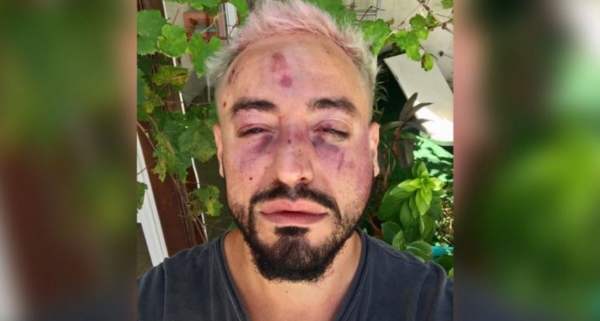 Brutal ataque homof&oacute;bico a un dise&ntilde;ador en Resistencia