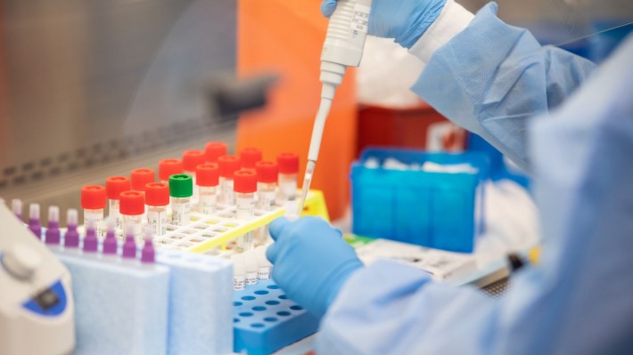 Coronavirus: un nuevo caso confirmado en el Chaco