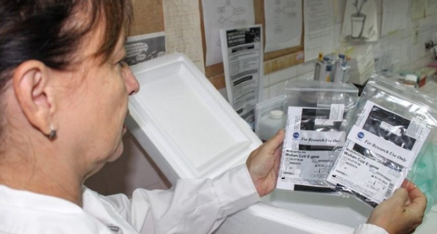 CHACO YA REALIZA EL TESTEO LOCAL DE MUESTRAS PARA DETECTAR CORONAVIRUS