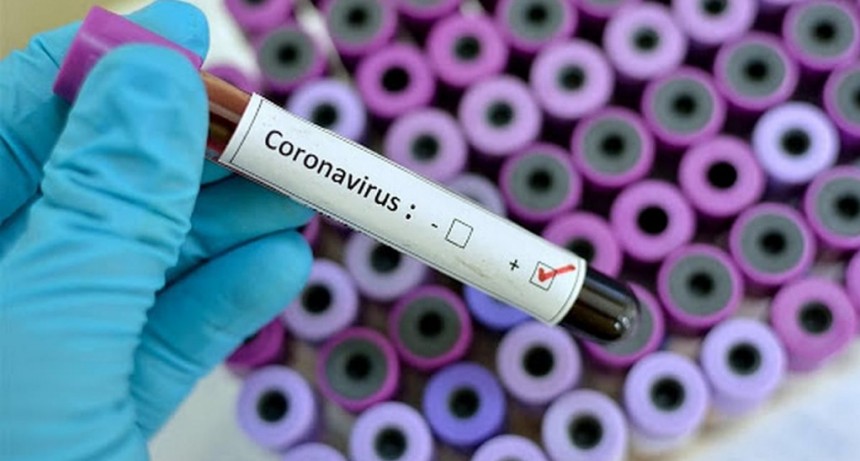Coronavirus: 80 personas ya se recuperaron en el pa&iacute;s
