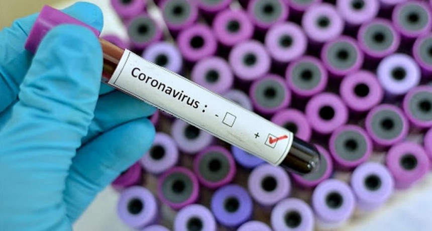 Coronavirus: el Gobierno confirm&oacute; una nueva muerte en Chaco y ya son 34 las v&iacute;ctimas fatales en Argentina