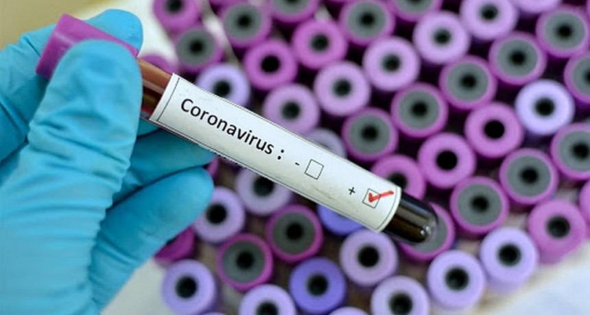 Confirmaron dos nuevas muertes por coronavirus y ya son 36 las v&iacute;ctimas fatales en la Argentina