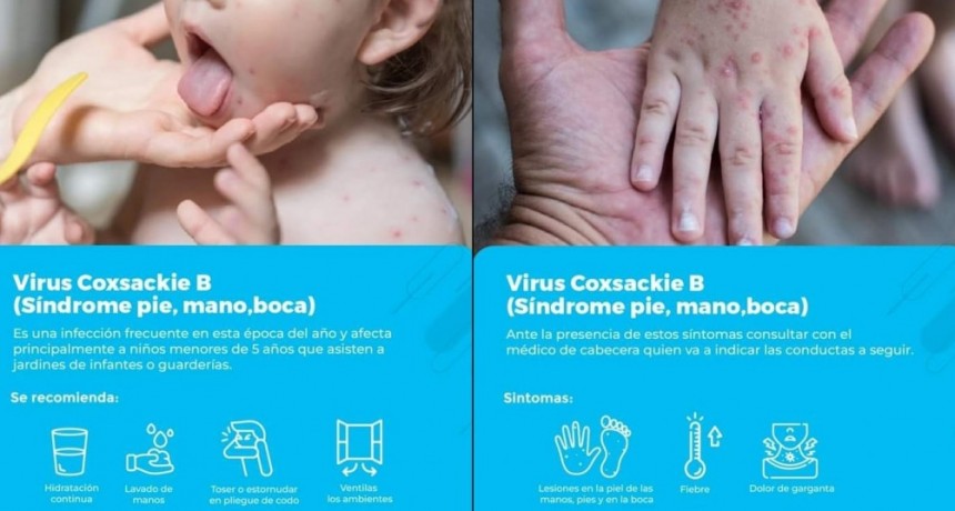 Villa &Aacute;ngela: LA DIRECTORA DE ZONA SANITARIA EXPLICA LOS S&Iacute;NTOMAS Y CONSECUENCIAS DEL VIRUS COXSACKIE B | &ldquo;Que produce diarrea, v&oacute;mitos y alergia o sarpullido en boca, manos y pies, mayormente en los ni&ntilde;os&rdquo;