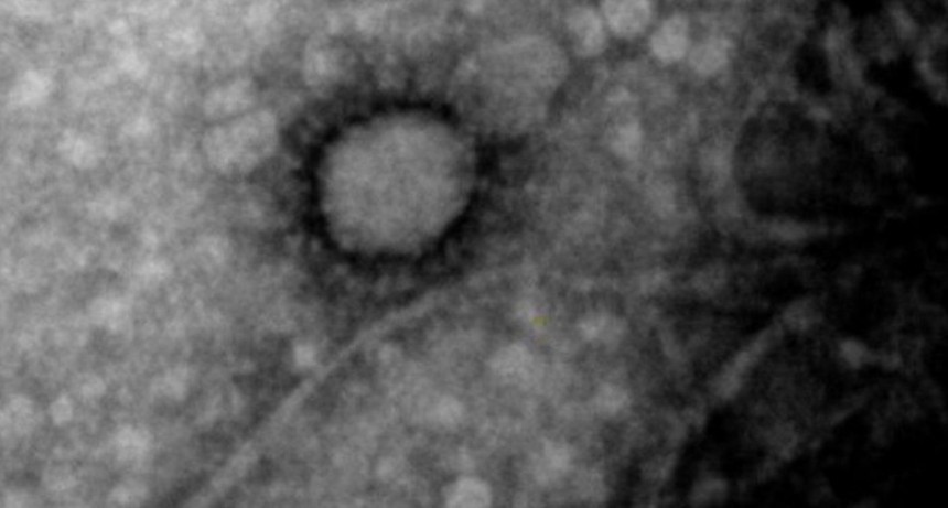 Muri&oacute; otro hombre en Chaco por coronavirus