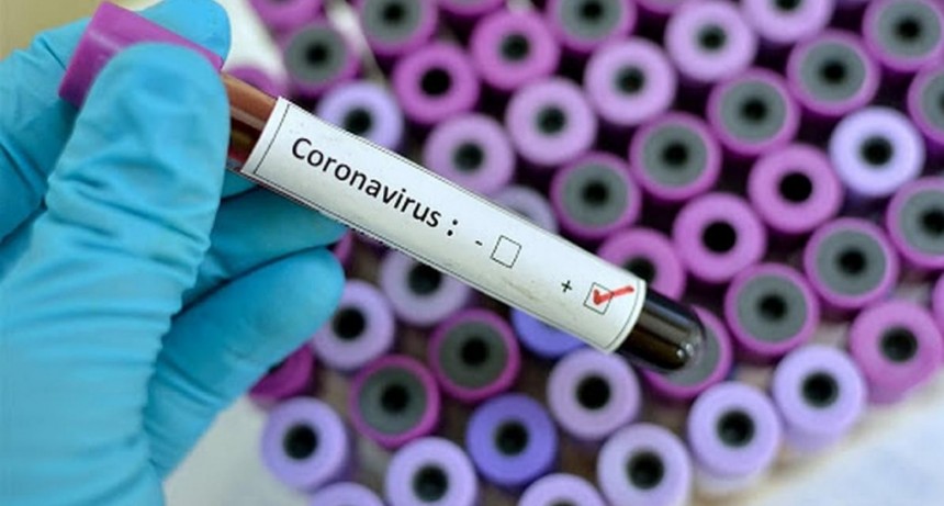 Coronavirus en Chaco: este viernes se registraron 54 nuevos casos
