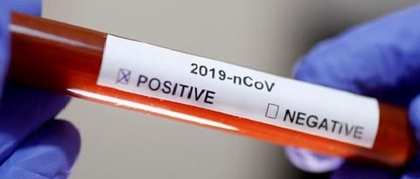 Gancedo: lamentablemente confirman un nuevo caso positivo de Coronavirus