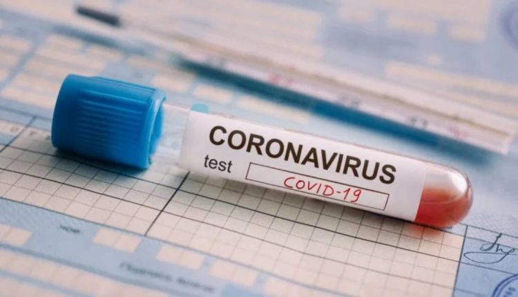 Villa &Aacute;ngela: LAS MUESTRAS PARA CORONAVIRUS TOMADAS A LA JOVEN Y LA FAMILIA ARROJARON NEGATIVO. 