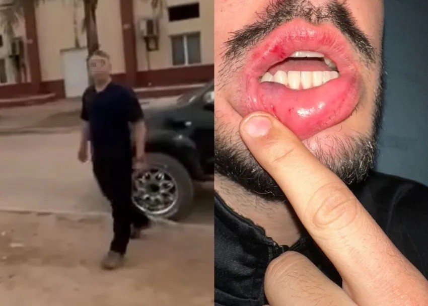 Taco Pozo: denunciaron a un jefe policial por golpes y detención arbitraria