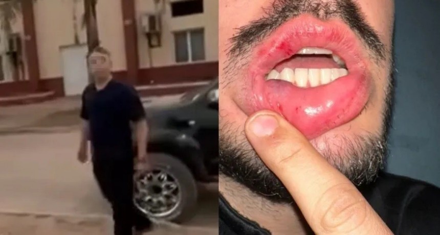 Taco Pozo: denunciaron a un jefe policial por golpes y detenci&oacute;n arbitraria