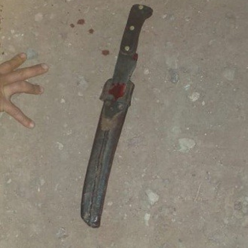 La Tigra: Tras un Disturbio Callejero un Hombre result&oacute; Lesionado y Trasladado al Hospital 4 de Junio