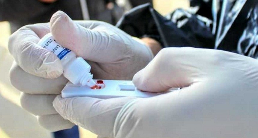 REPORTE VESPERTINO NACIONAL- Coronavirus: tres hombres murieron y se suman 20 nuevos casos en el Chaco