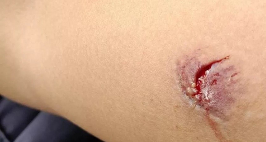 Quiso llevarse mercader&iacute;a robada, lo demoraron y mordi&oacute; a un polic&iacute;a