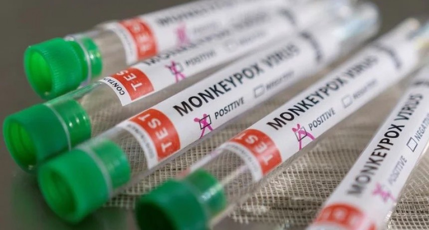 Reportan 221 casos de la viruela del mono en la Argentina
