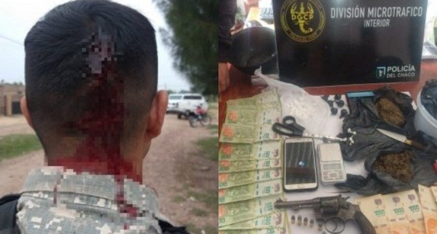 Un polic&iacute;a result&oacute; herido en un allanamiento en S&aacute;enz Pe&ntilde;a: secuestraron marihuana, coca&iacute;na, m&aacute;s de 15 mil pesos