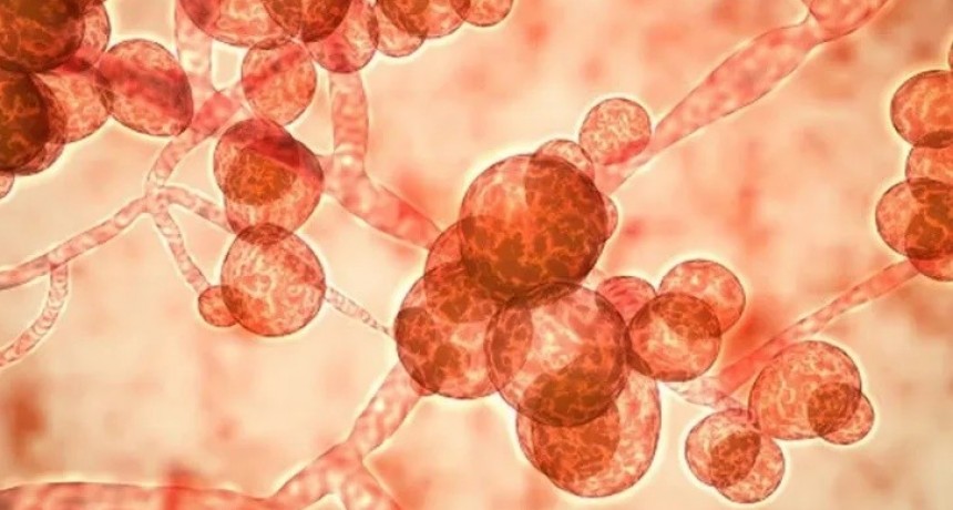 Detectan casos de Candida auris en Argentina &iquest;De qu&eacute; se trata?