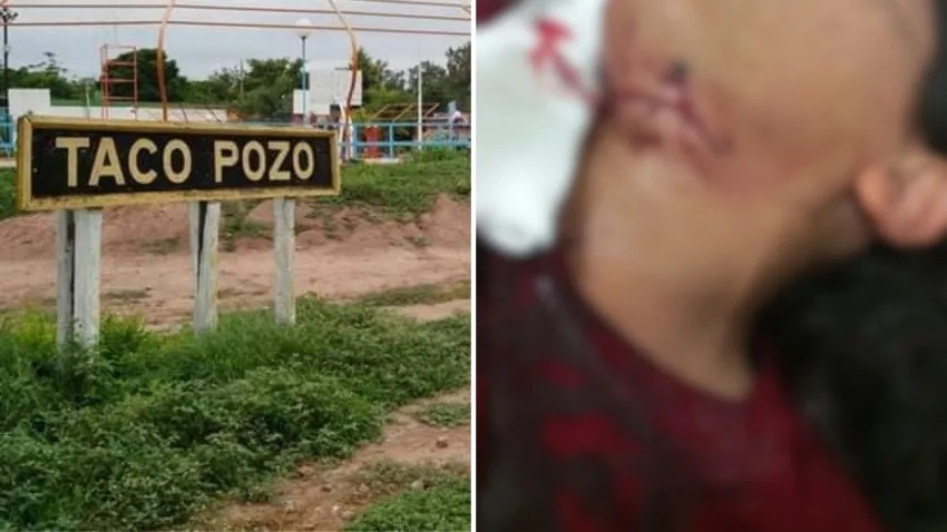 Taco Pozo: un hombre le cortó el cuello a su expareja