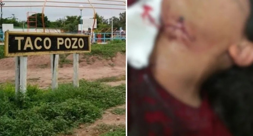 Taco Pozo: un hombre le cortó el cuello a su expareja